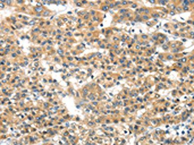 MMP9 Antibody