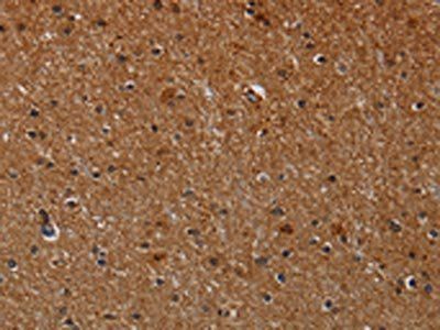 MMP9 Antibody