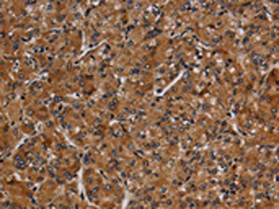 MMP9 Antibody