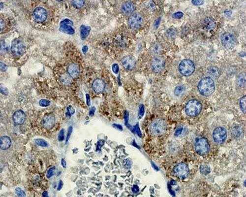 MMP9 antibody