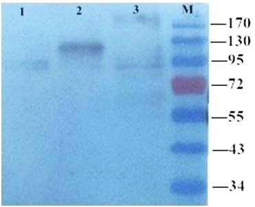 MMP9 antibody