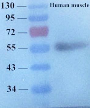 MMP9 antibody