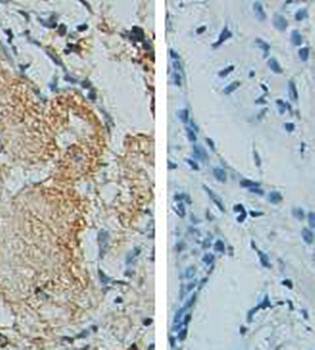 Mmp9 Rabbit Polyclonal Antibody
