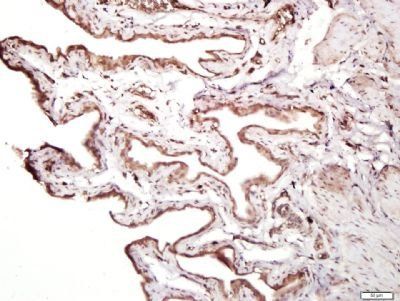 MMRN1 Rabbit Polyclonal Antibody