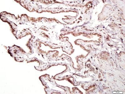 MMRN1 antibody