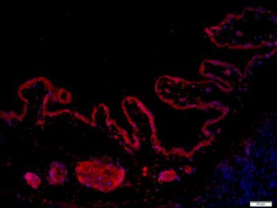 MMRN1 Rabbit Polyclonal Antibody