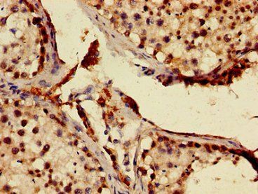 MNAT1 Antibody