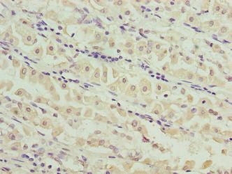 MND1 antibody