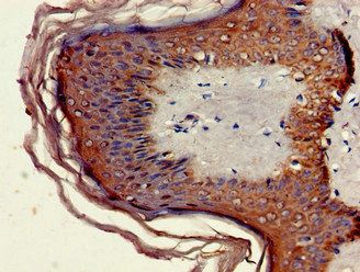 MNDA Antibody