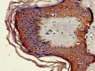 MNDA antibody