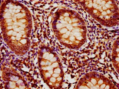 MOB1B Antibody