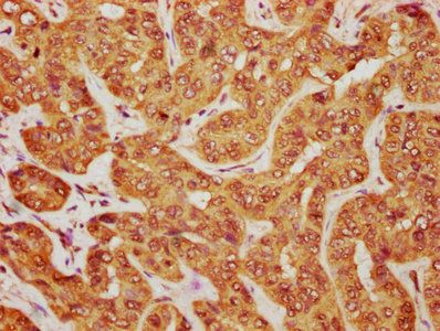 MOB1B Antibody