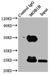 MOB kinase activator 1B antibody