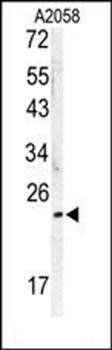 MOBKL1B antibody