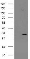 MOBKL2B Antibody
