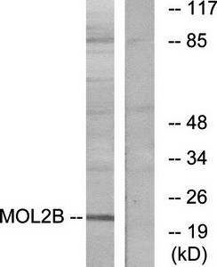 MOBKL2B Antibody