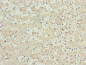 MOCS3 antibody