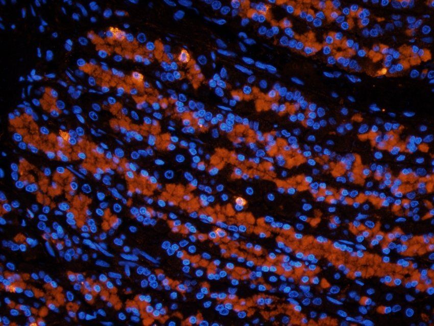 MOGAT1 antibody