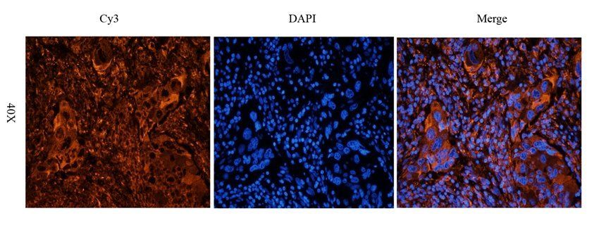 MOGAT1 antibody