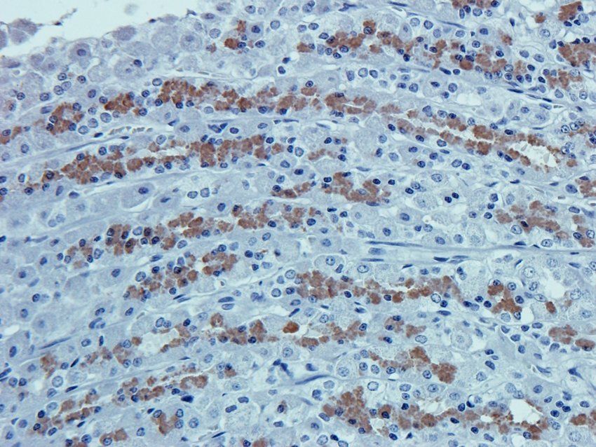 MOGAT1 antibody