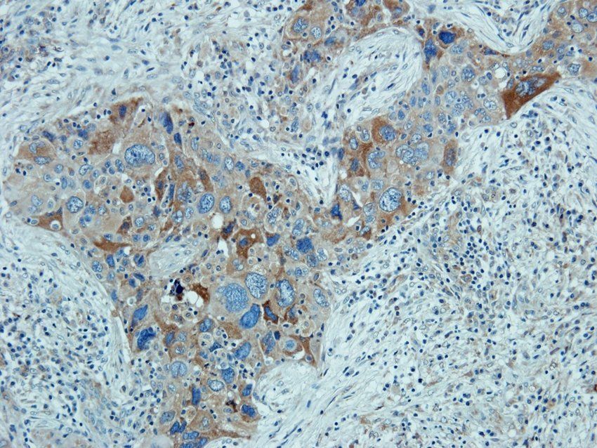 MOGAT1 antibody