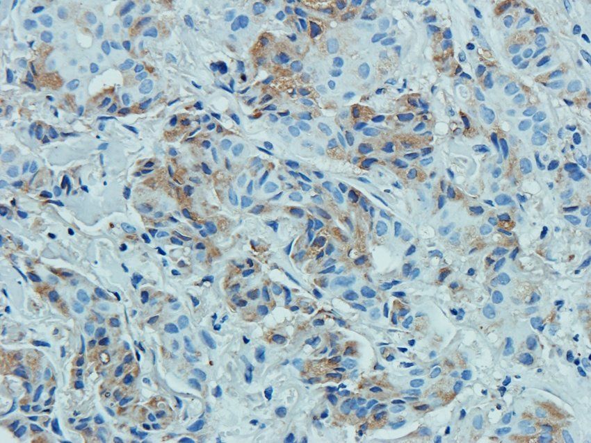 MOGAT1 antibody