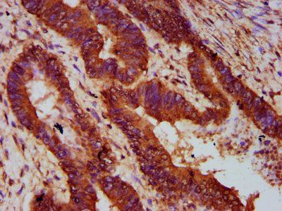 MOGAT1 Antibody