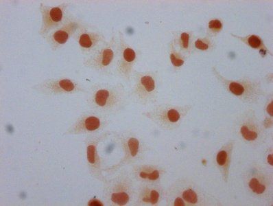 Mono-methyl-H1F0 (K101) Antibody