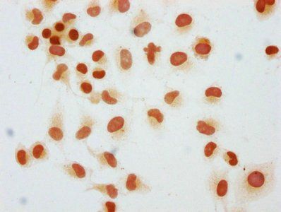 HIST1H1C Antibody