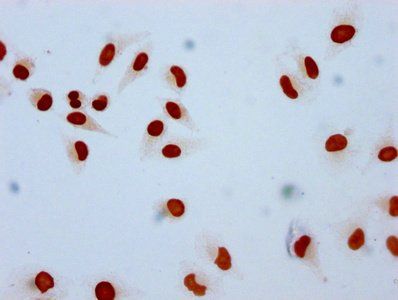 HIST1H2AG Antibody
