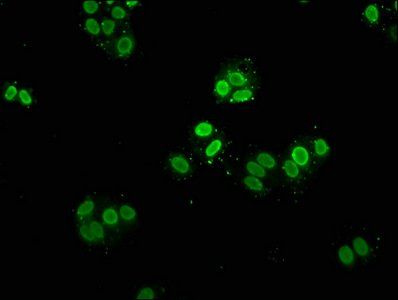 HIST1H2AG Antibody