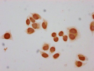 HIST1H2BC Antibody
