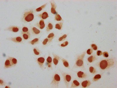 HIST1H2BC Antibody