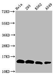 Mono-methyl-HIST1H2BC (K20) antibody