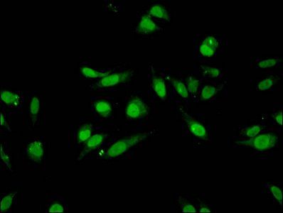 Mono-methyl-HIST1H3A (K27) Antibody