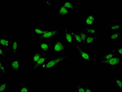 Mono-methyl-HIST1H3A (K27) antibody