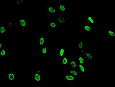 Mono-methyl-HIST1H3A (K36) Antibody