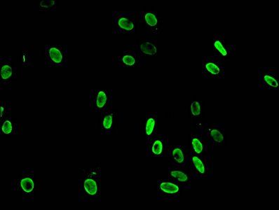 Mono-methyl-HIST1H3A (K36) antibody