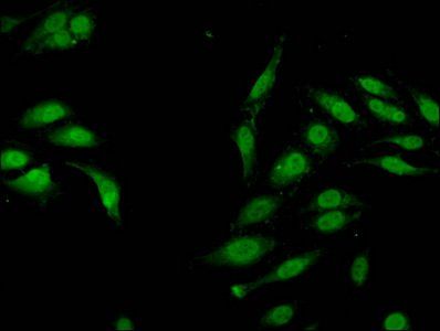 Mono-methyl-HIST1H3A (K4) Antibody