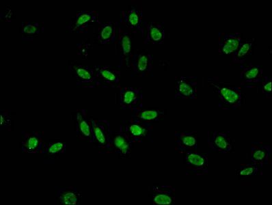 Mono-methyl-HIST1H3A (K9) Antibody