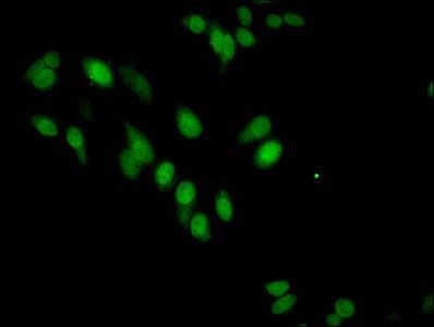 Mono-methyl-HIST1H3A (R17) Antibody