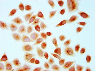 HIST1H4A Antibody