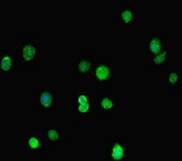 MORC1 Antibody