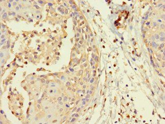 MORC1 Antibody
