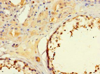 MORC1 Antibody