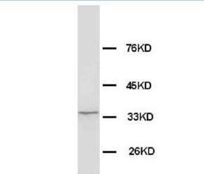 Anti-Morg1/WDR83 Antibody