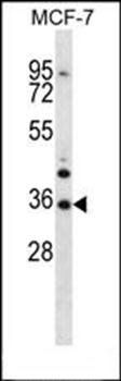 MORN3 antibody