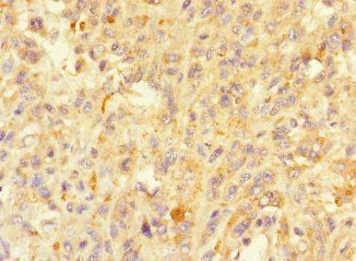 MORN5 Antibody
