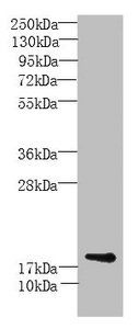 MORN5 antibody