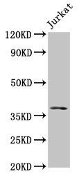 MOS antibody